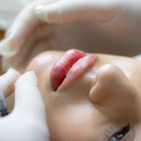 Enhance your lips